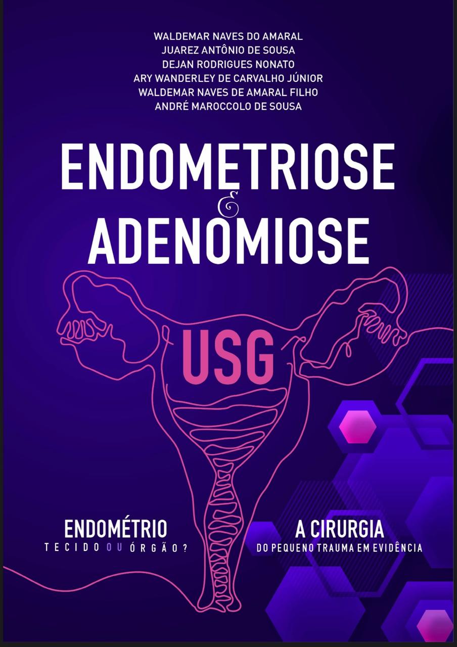Endometriose e Adenomiose