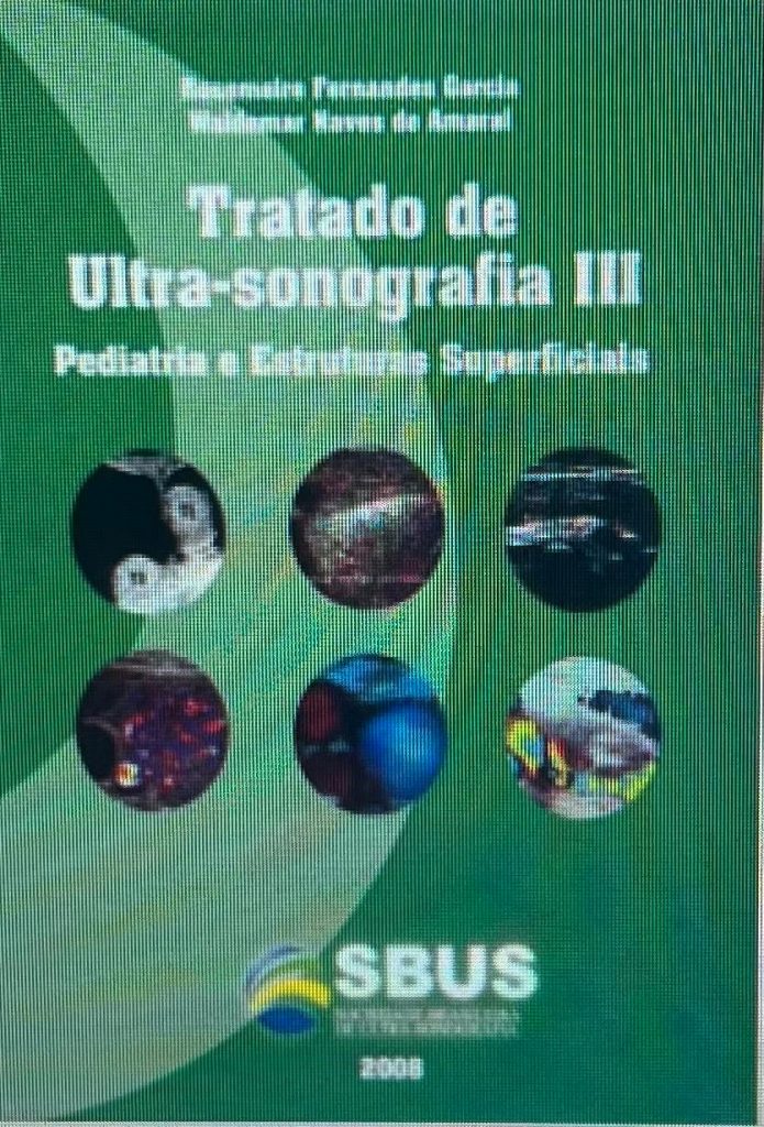 Tratado de Ultra-sonografia III: Pediatria e Estruturas Superficiais