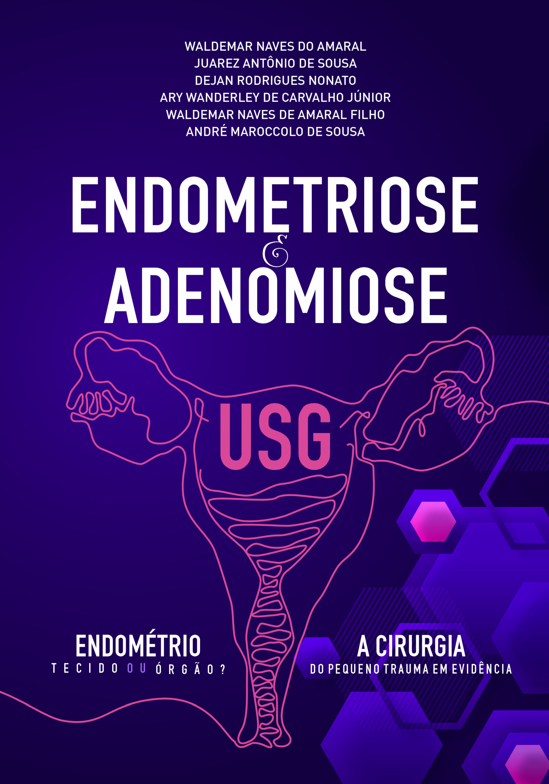 Endometriose e Adenomiose
