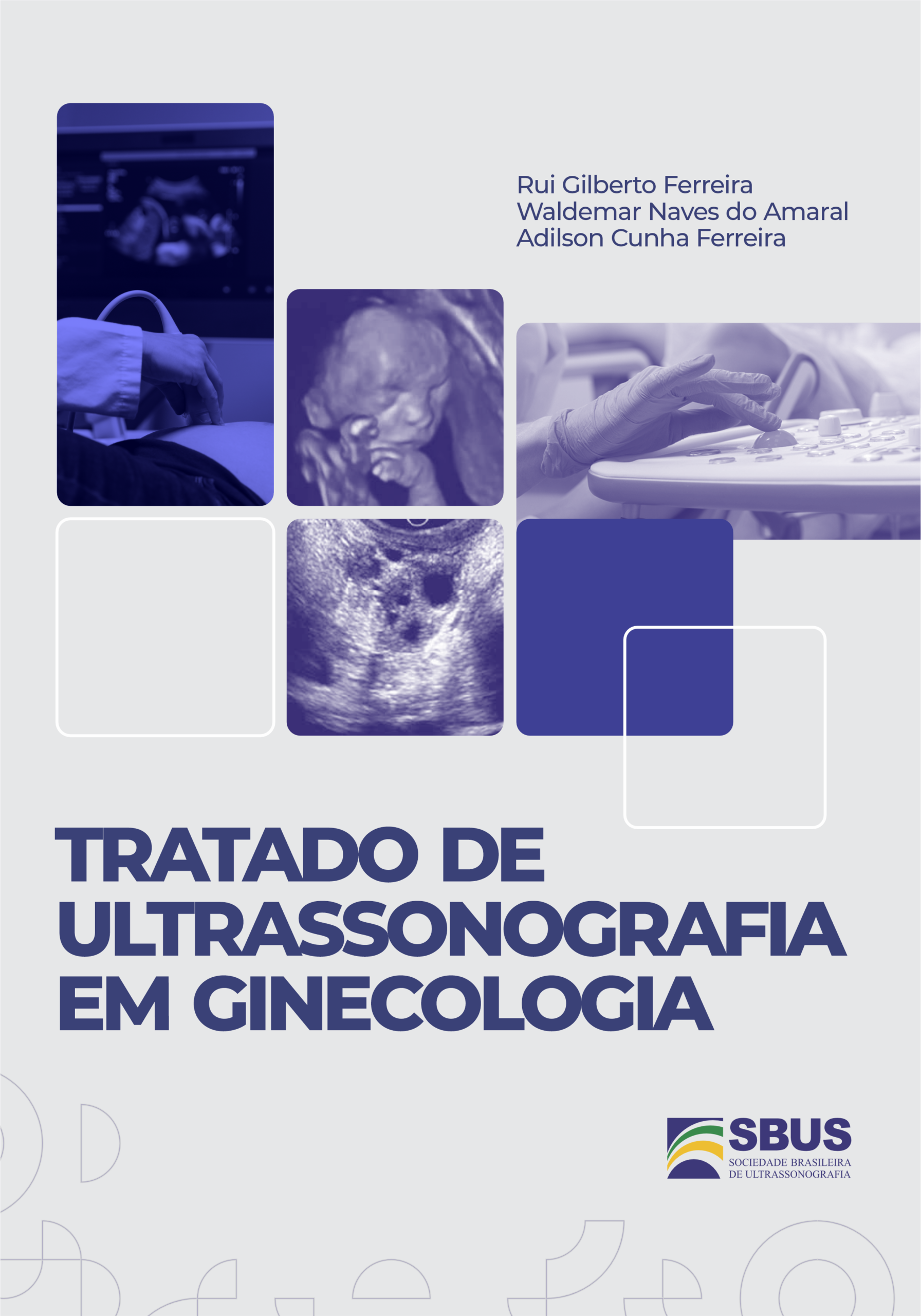 Tratado de Ultrassonografia em Ginecologia