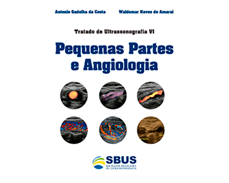 Pequenas Partes e Angiologia – Tratado de Ultrassonografia VI
